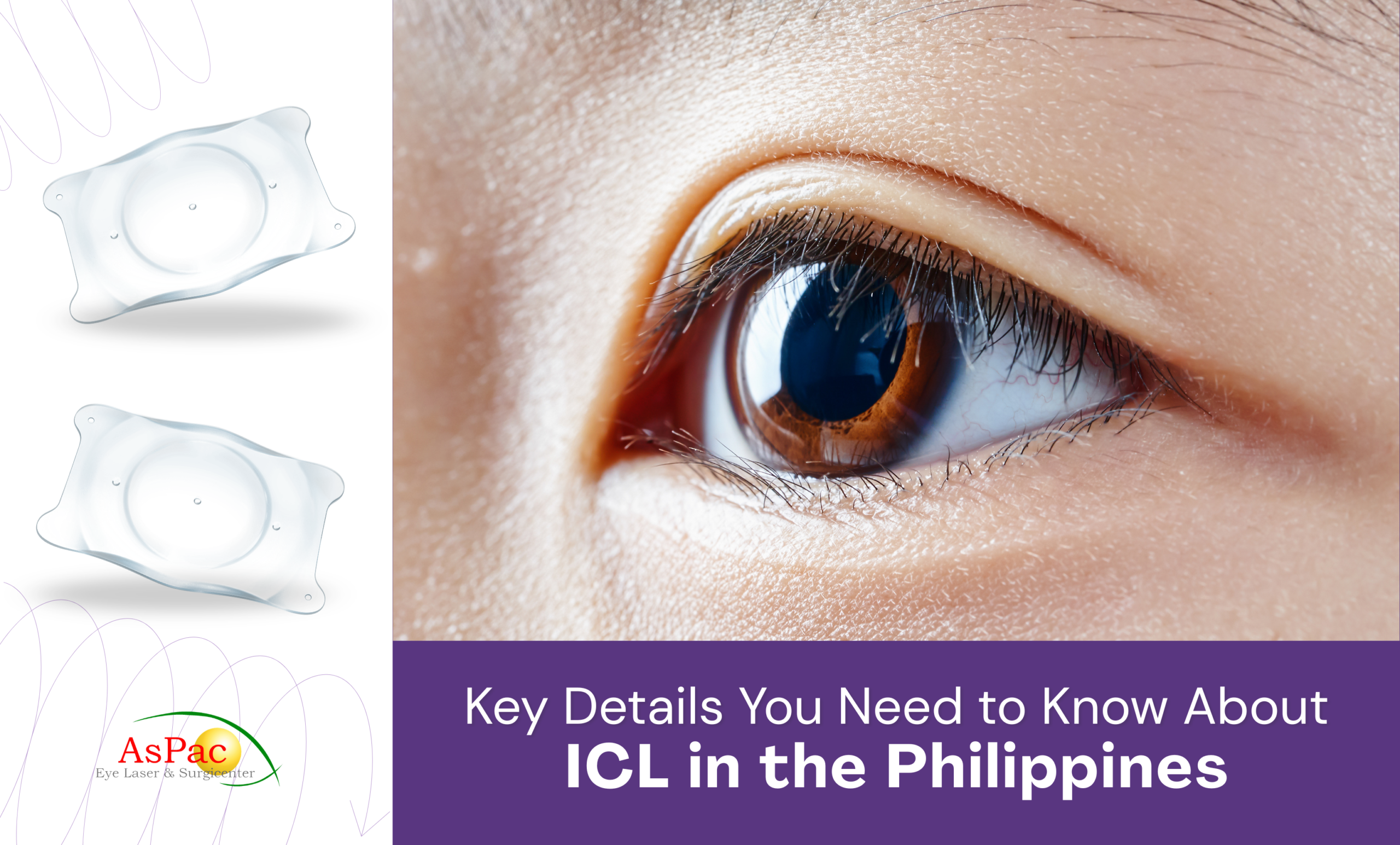 Key Details to Know About ICL Eye Surgery